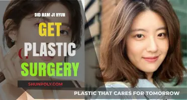 Nam Ji Hyun Plastic Surgery: Fact-Checking the Rumors and Speculations