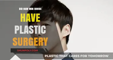 Nam Min Goong Plastic Surgery: Fact or Fiction?