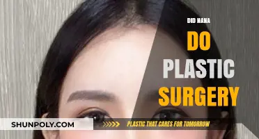 Did Nana Undergo Plastic Surgery? Unveiling the Truth Behind Her Look