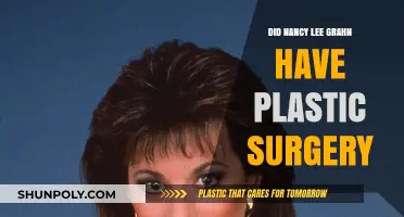 Nancy Lee Grahn's Transformation: Plastic Surgery Speculations Explored