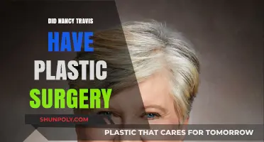 Nancy Travis Plastic Surgery: Fact-Checking the Rumors and Speculations