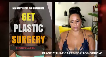 Nany from The Challenge: Plastic Surgery Speculations and Truths