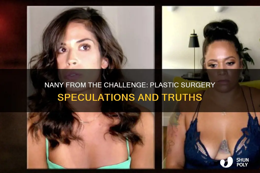 did nany from the challenge get plastic surgery