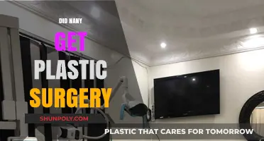 Did Nany Undergo Plastic Surgery? Unveiling the Truth and Speculations