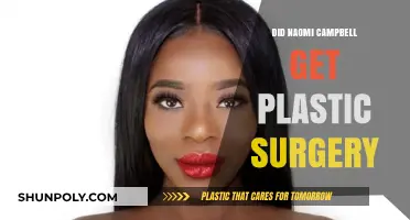 Naomi Campbell Plastic Surgery: Fact-Checking the Rumors and Speculations
