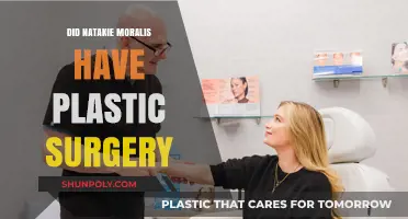 Natakie Moralis Plastic Surgery: Fact-Checking the Rumors and Speculations