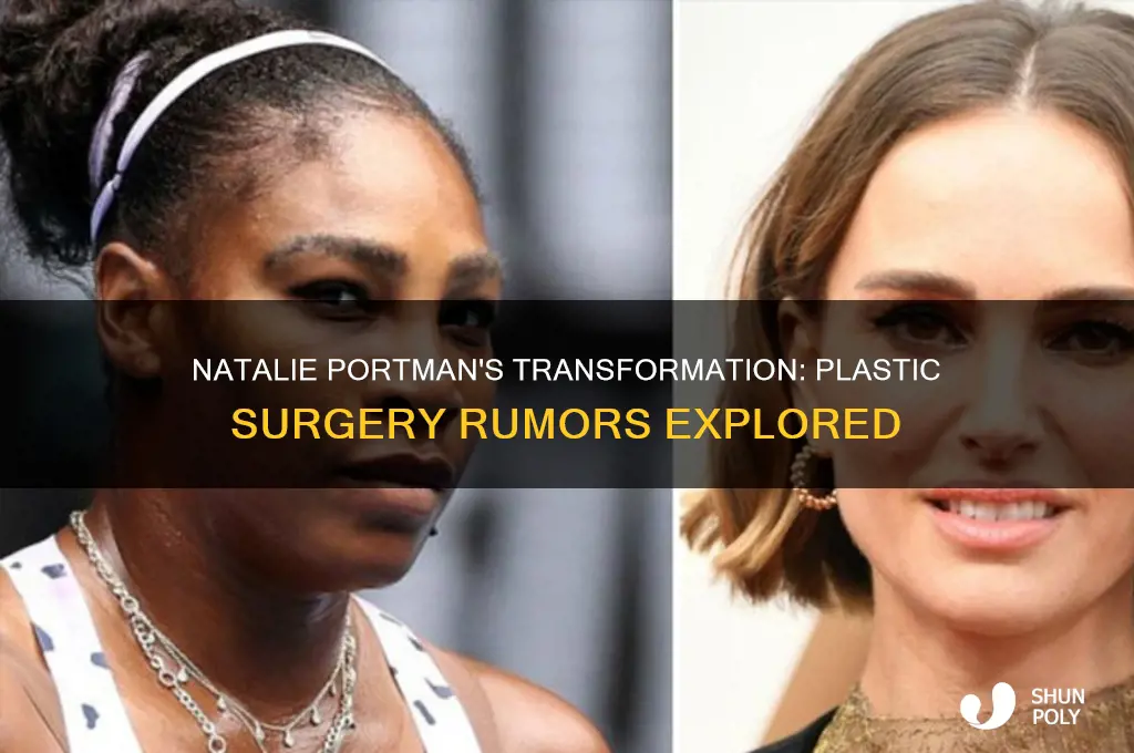 did natalie portman get plastic surgery