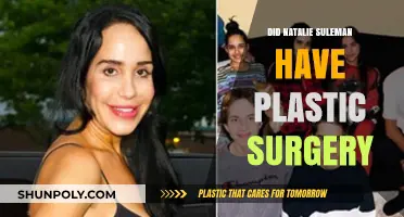 Natalie Suleman's Transformation: Plastic Surgery Speculations and Truths