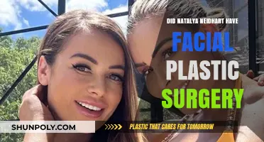 Natalya Neidhart's Facial Transformation: Plastic Surgery Speculations Explored