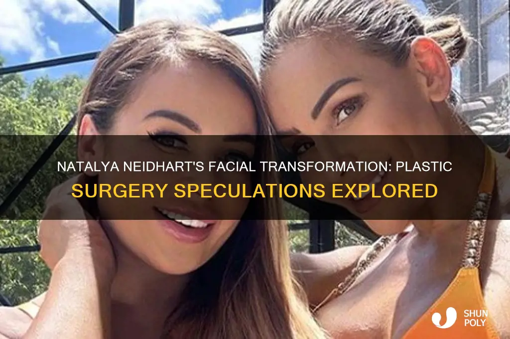did natalya neidhart have facial plastic surgery