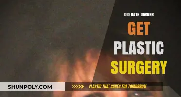 Nate Garner Plastic Surgery: Fact or Fiction? Uncovering the Truth