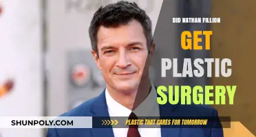 Nathan Fillion Plastic Surgery: Fact-Checking the Rumors and Speculations