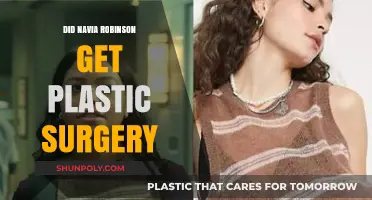 Navia Robinson Plastic Surgery: Fact-Checking the Rumors and Speculations