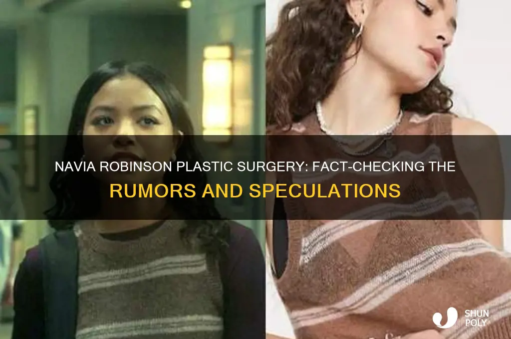 did navia robinson get plastic surgery