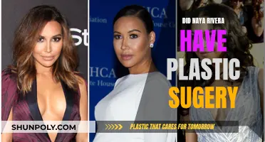 Plastic Surgery Speculation: Naya Rivera's Transformation