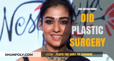 Nayanthara's Transformation: Plastic Surgery Speculations and Truth Revealed