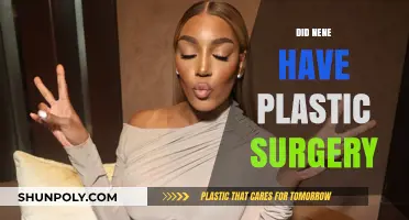 Nene's Transformation: Unveiling the Truth About Plastic Surgery Speculations