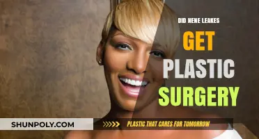 Nene Leakes Plastic Surgery: Fact-Checking the Rumors and Speculations