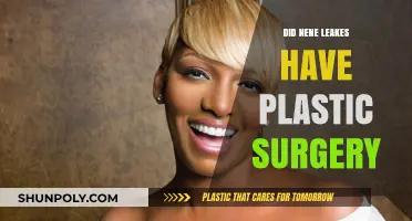 Nene Leakes Plastic Surgery: Fact-Checking Her Transformation Rumors