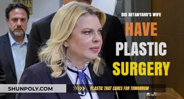 Sara Netanyahu's Transformation: Plastic Surgery Speculations and Public Reactions