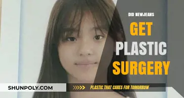 Unveiling the Truth: NewJeans and Plastic Surgery Rumors Explored