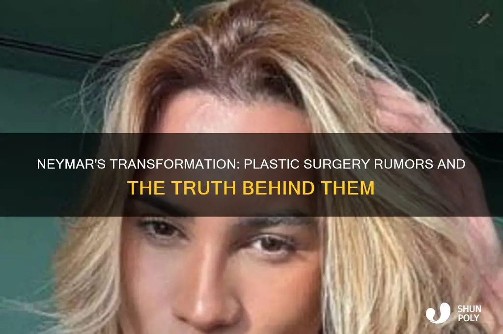 did neymar get plastic surgery