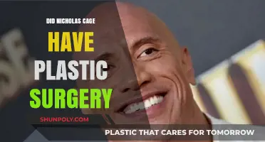 Unveiling the Truth: Did Nicholas Cage Undergo Plastic Surgery?