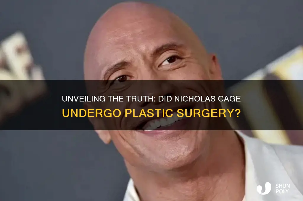 did nicholas cage have plastic surgery