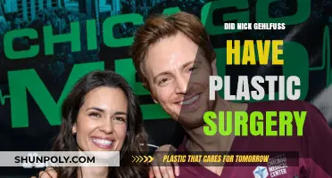Did Nick Gehlfuss Undergo Plastic Surgery? Uncovering the Truth