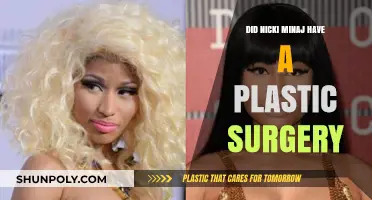 Nicki Minaj's Transformation: Plastic Surgery Rumors and Reality Revealed
