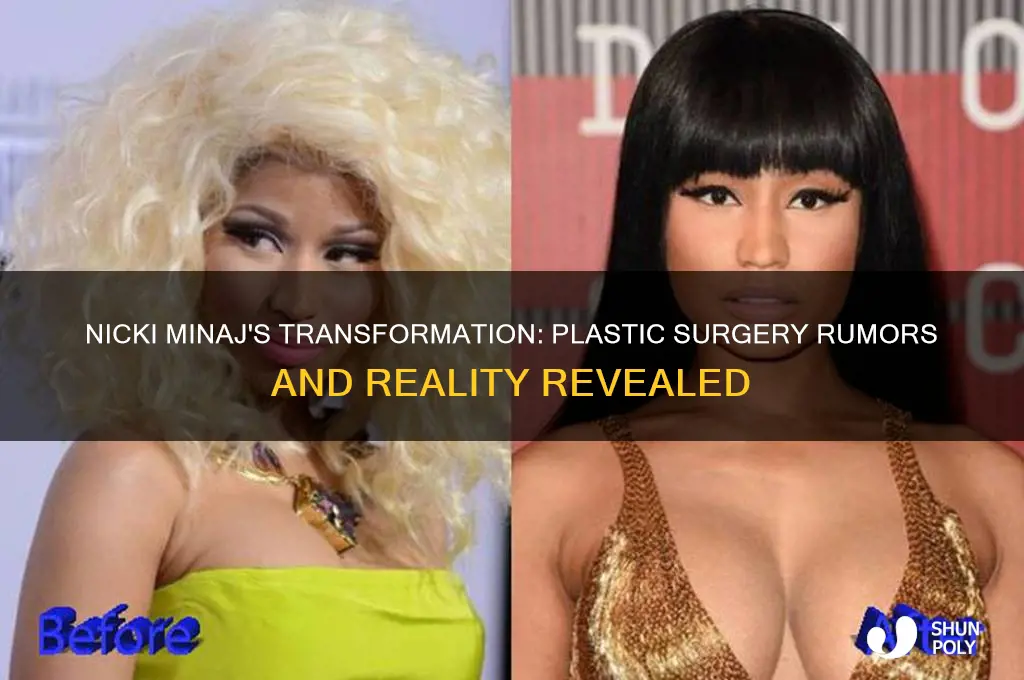 did nicki minaj have a plastic surgery