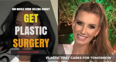 Nicole From Selling Sunset: Plastic Surgery Rumors Explored