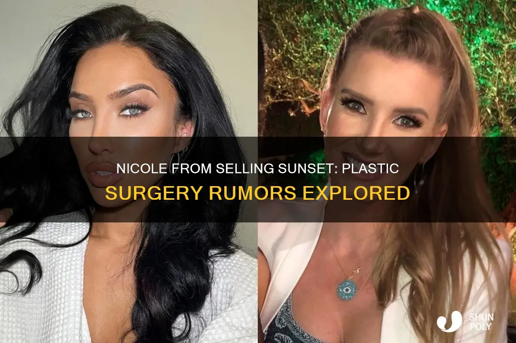 did nicole from selling sunset get plastic surgery