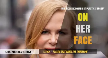 Nicole Kidman's Face Transformation: Plastic Surgery or Natural Aging?