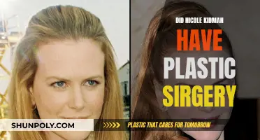 The Evolution of Nicole Kidman's Appearance: Natural or Enhanced?