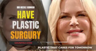 Plastic Surgery Speculation: Nicole Kidman's Transformation