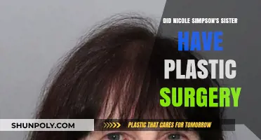 Nicole Simpson's Sister: Plastic Surgery Speculations and Truths Revealed