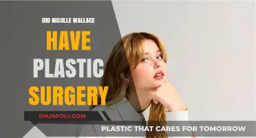 Nicolle Wallace Plastic Surgery: Fact-Checking the Rumors and Speculations