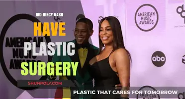 Niecy Nash's Transformation: Plastic Surgery Rumors Explored