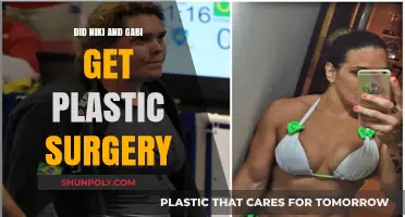 Niki and Gabi's Transformation: Plastic Surgery Speculations Explored
