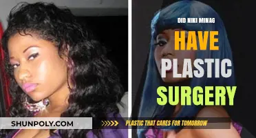 Nicki Minaj's Transformation: Plastic Surgery Rumors and Reality Revealed