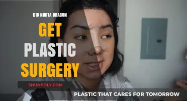 Nikita Dragun's Transformation: Plastic Surgery Rumors Explored