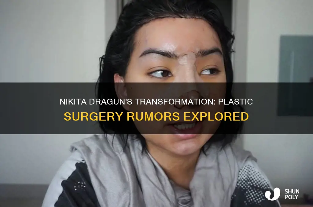 did nikita dragun get plastic surgery