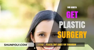 Nikita's Transformation: Unveiling the Truth About Plastic Surgery Rumors