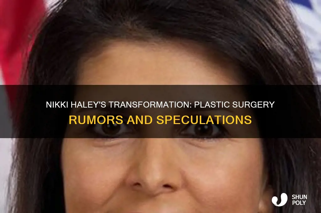 did nikki haley have plastic surgery