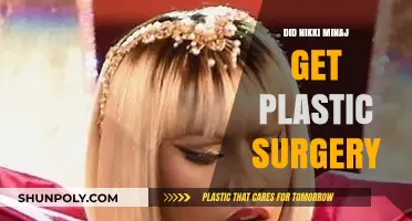 Nikki Minaj's Transformation: Plastic Surgery Rumors and Realities Explored