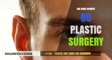 Nina Dobrev Plastic Surgery: Fact-Checking the Rumors and Speculations