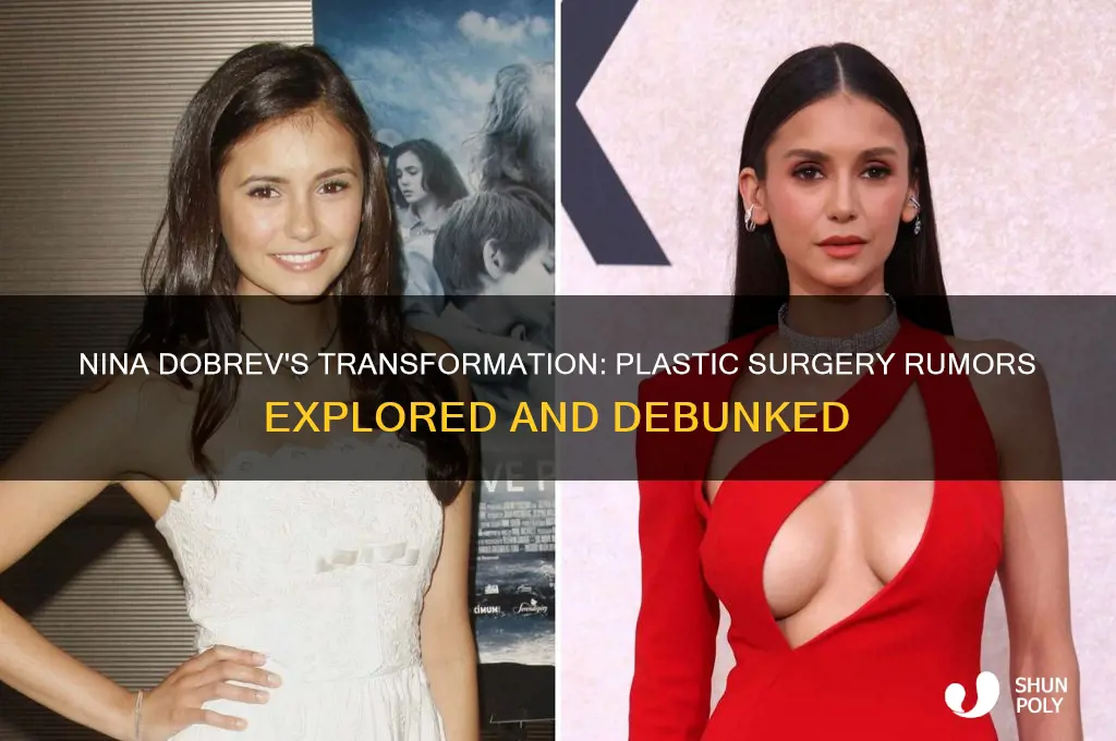 did nina dobrev have plastic surgery