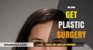 Nina's Transformation: Plastic Surgery Speculations and Truths Revealed
