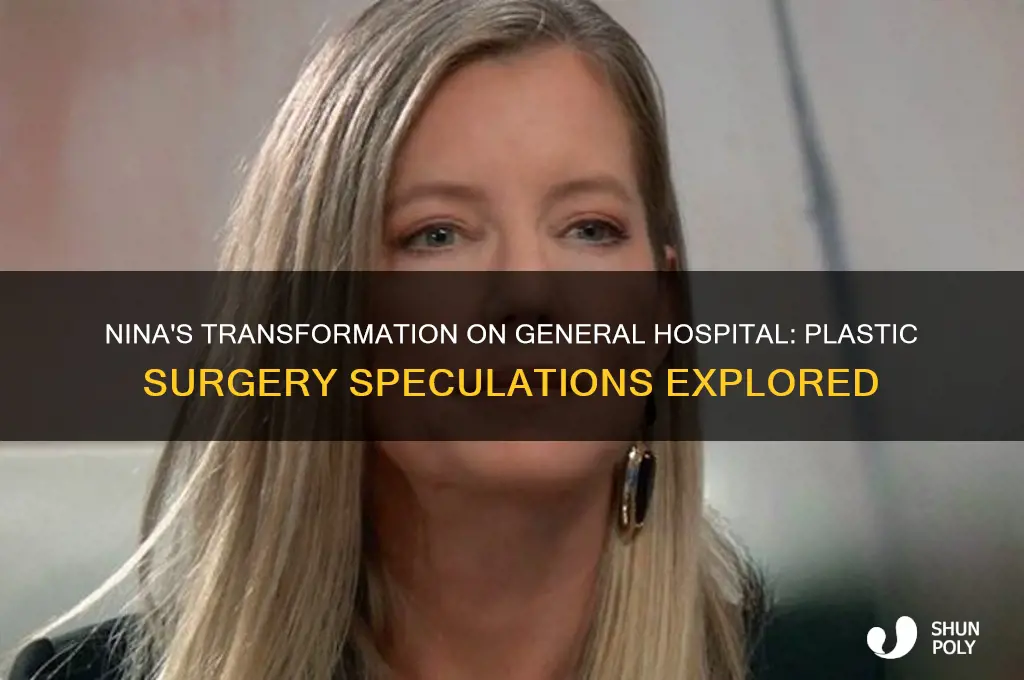 did nina on general hospital have plastic surgery
